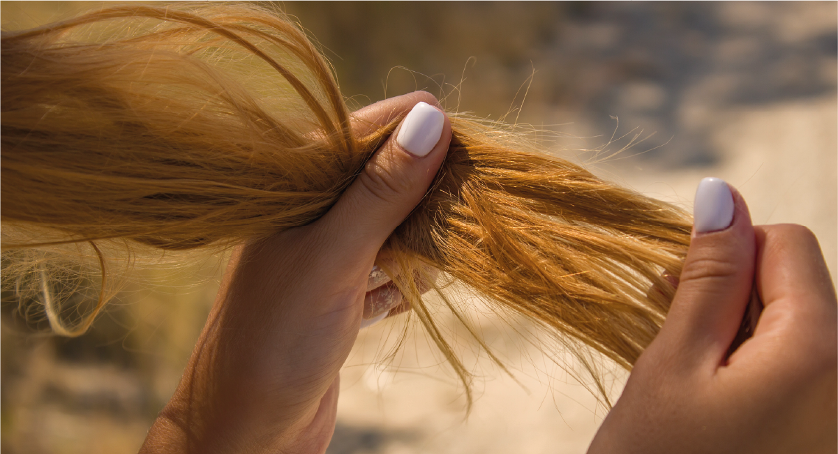 Caída del pelo en mujeres