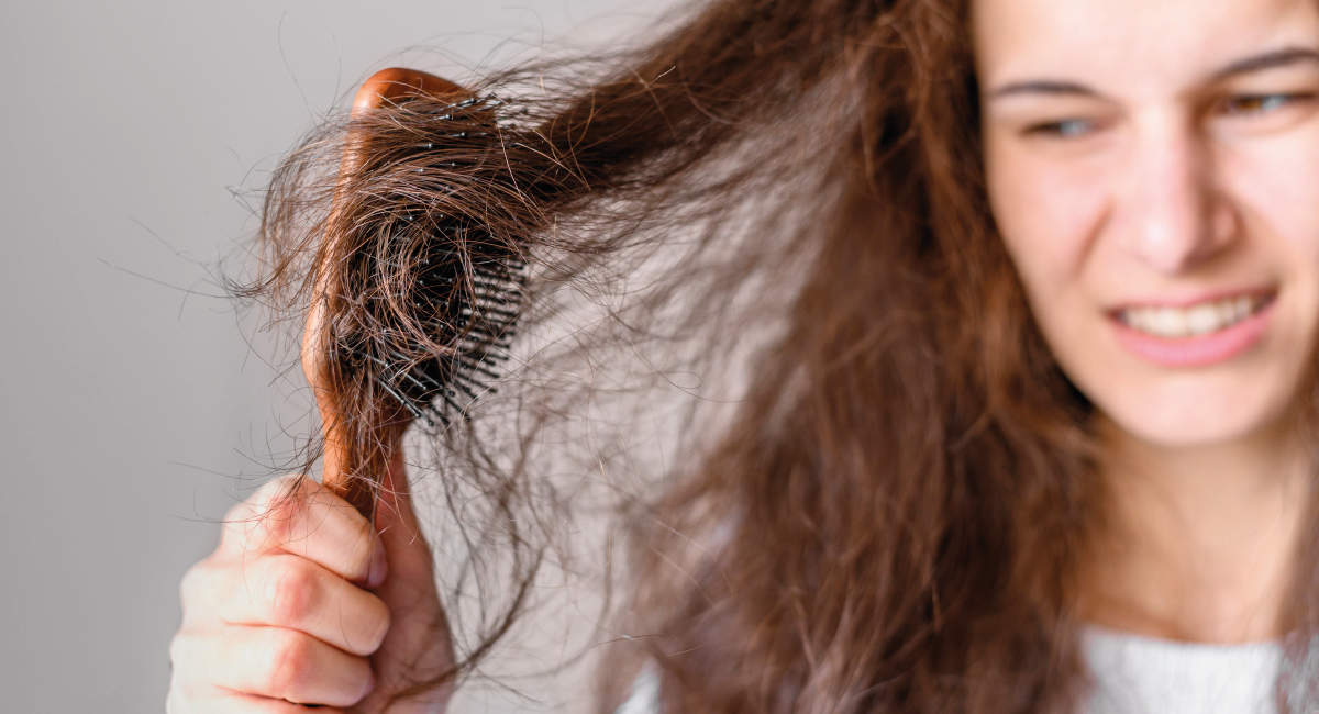 Imagen clínica capilar caída del pelo_Mesa de trabajo 1