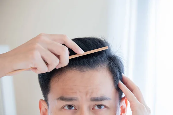 cómo hacer crecer cabello en la frente
