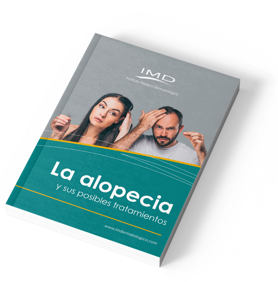 Ebook gratuito sobre la alopecia y sus posibles tratamientos IMD