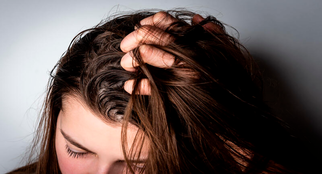 mujer enseñando su cabello muy graso