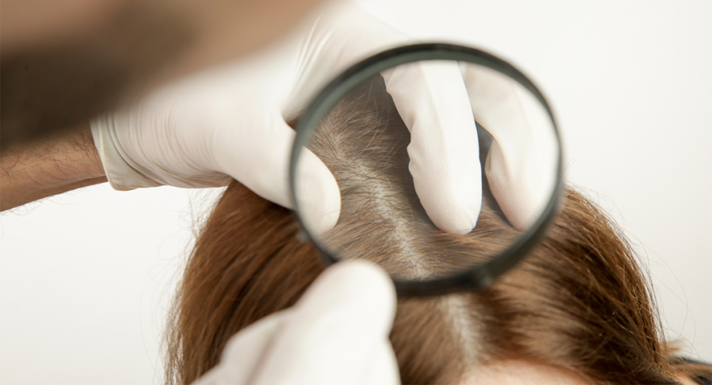 Médico analizando el cuero cabelludo de una mujer