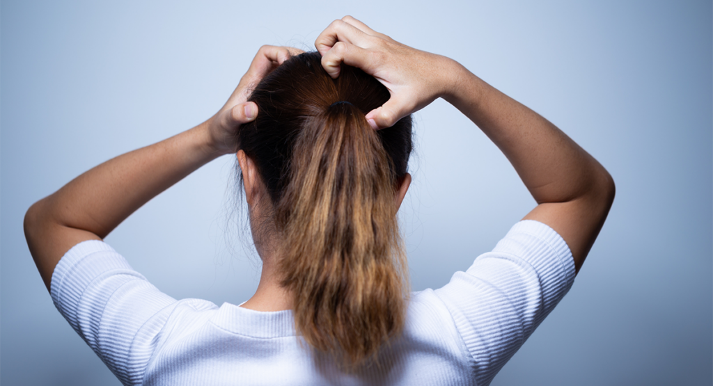 Mujer rascándose el cuero cabelludo debido al acné capilar