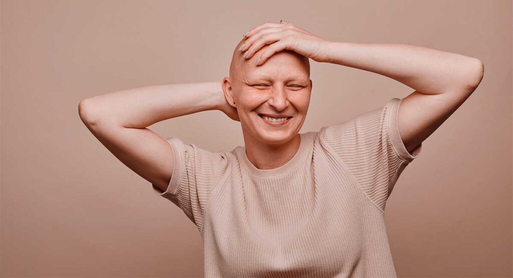 Mujer sonriente enseñando su alopecia universal
