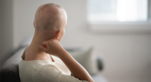 Alopecia Femenina