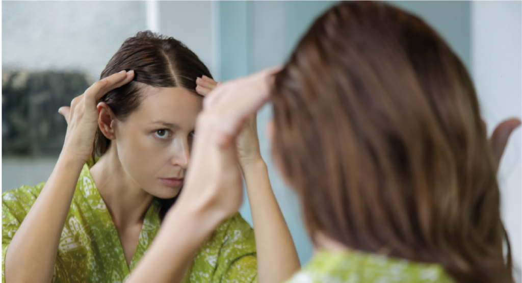 Alopecia femenina y tratamientos capilares