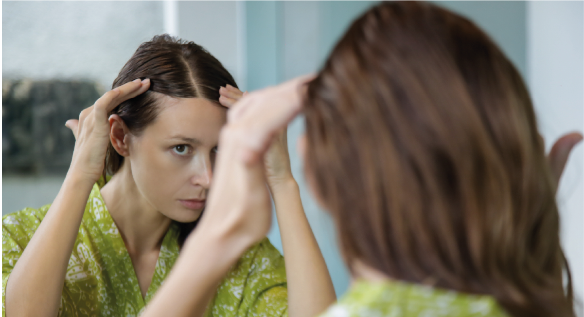 Alopecia femenina y tratamientos capilares