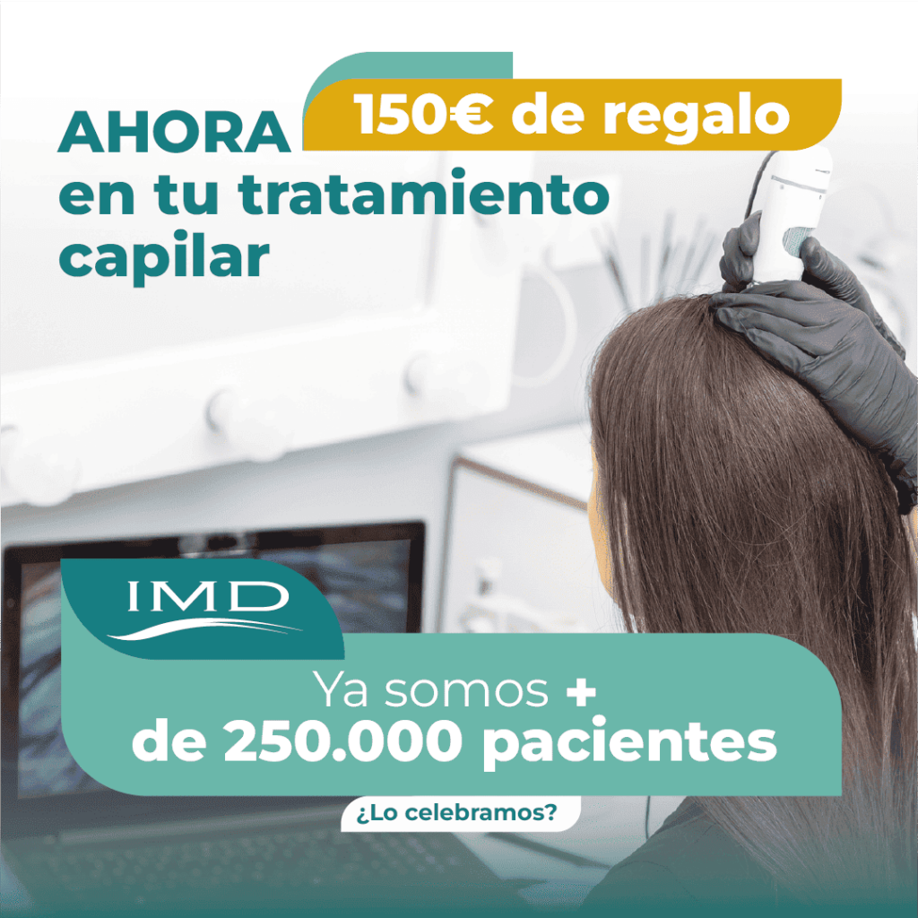 Promo 150 euros