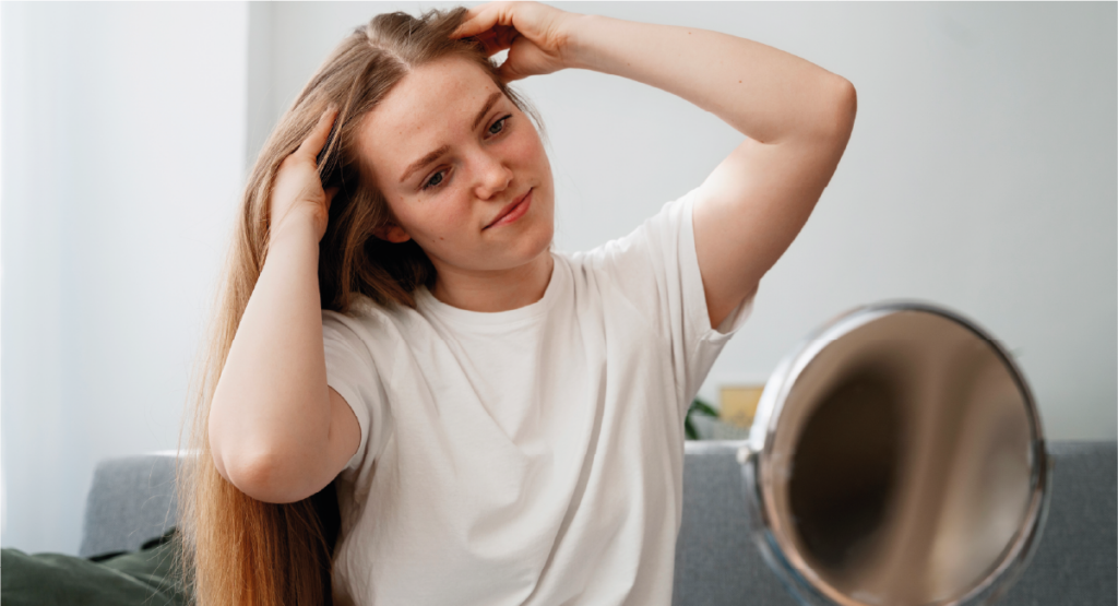 Alopecia feminina