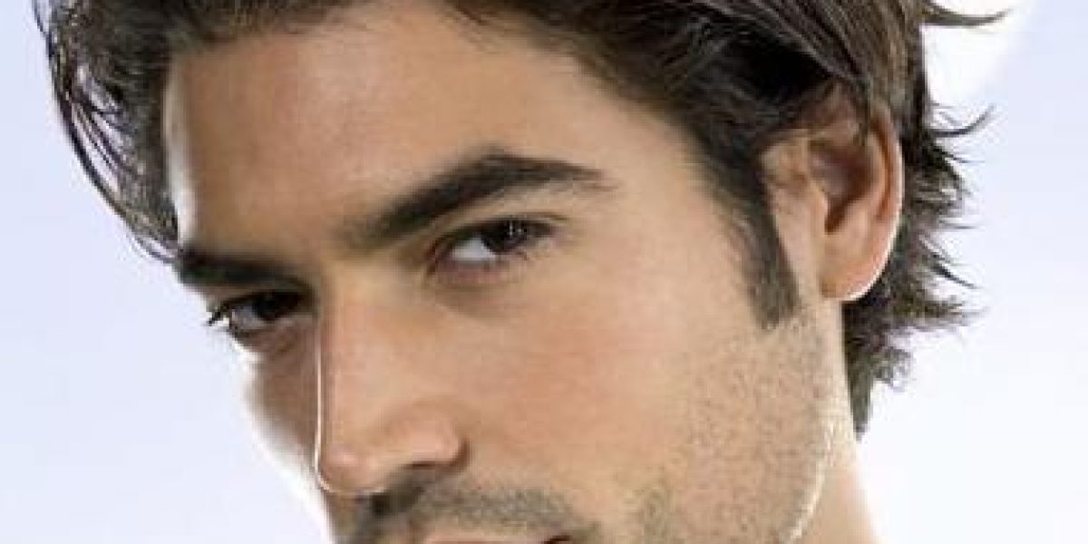 alopecia-hombres-soluciones-capilares-imd