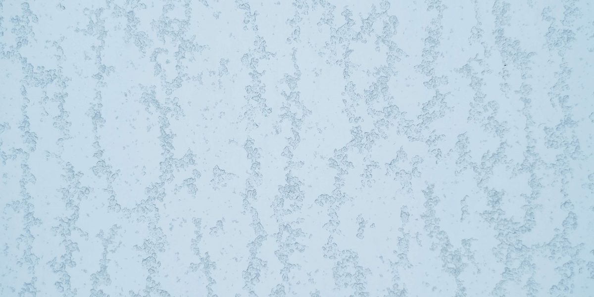 la-dermatitis-seborreica-es-mas-comun-en-hombres