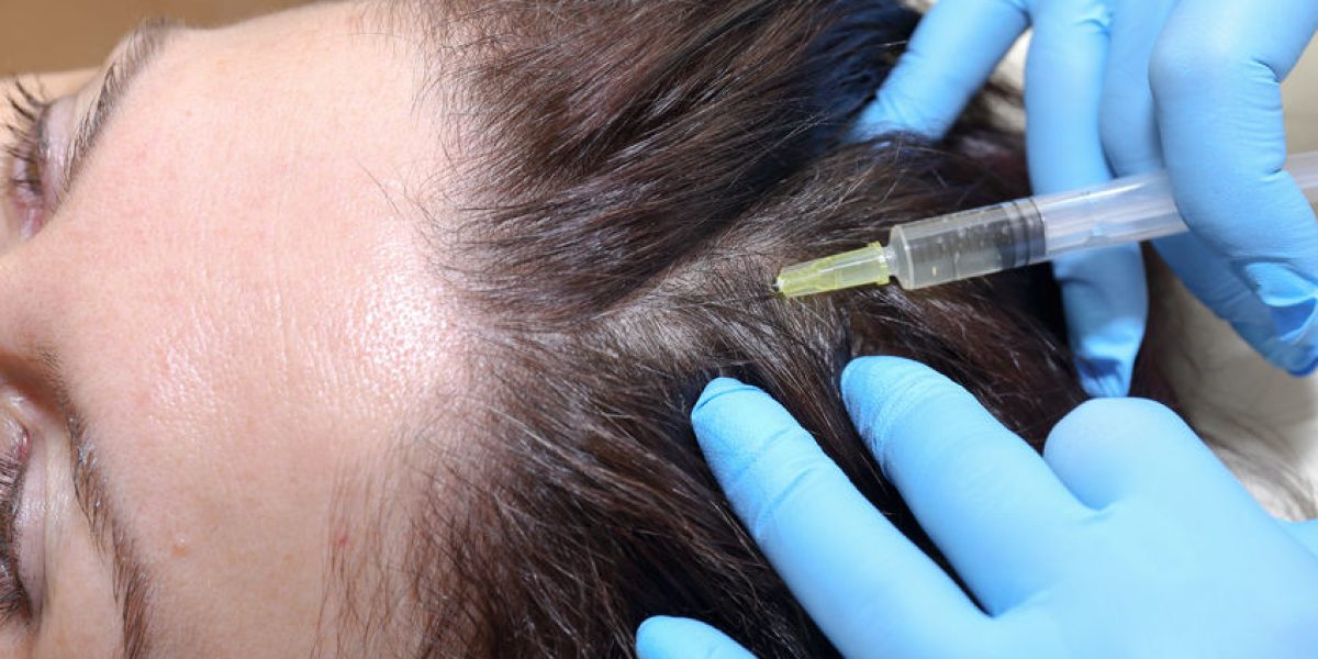 60994742 - anti hair loss injection in clinic